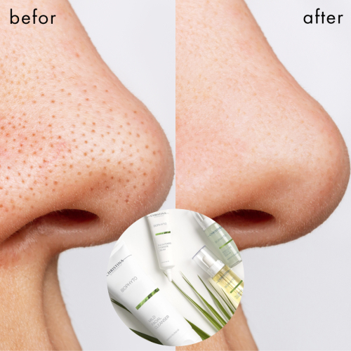 【＋】毛穴きれいスッキリ！Noseハーブパック